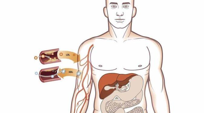 Tratamento: veja como identificar e prevenir o colesterol alto