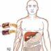 Tratamento: veja como identificar e prevenir o colesterol alto