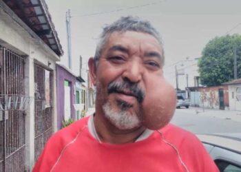 Homem com cisto no rosto é encontrado morto; Polícia investiga o caso