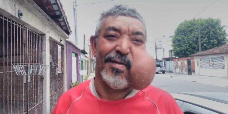 Homem com cisto no rosto é encontrado morto; Polícia investiga o caso