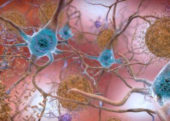 Medicamento que age em causas do Alzheimer tem resultado limitado