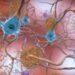 Medicamento que age em causas do Alzheimer tem resultado limitado