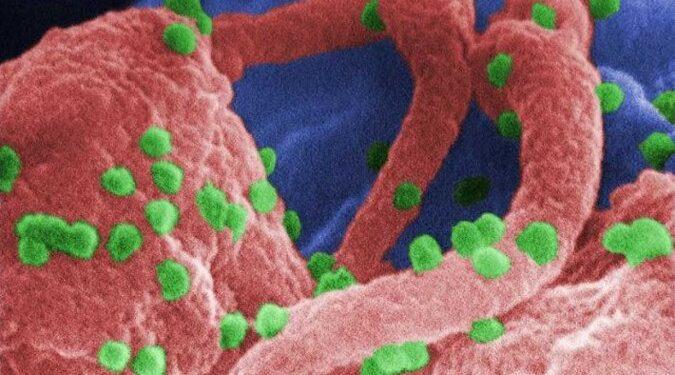 Após sucesso em teste com humanos, vacina contra Aids está mais próxima