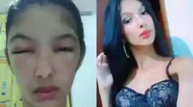 Influencer de BH viraliza ao mostrar rosto desfigurado após pintar o cabelo