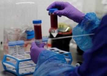 Exame pode acusar Alzheimer 10 anos antes, diz estudo