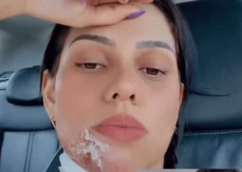 DJ que disparou canhão de confete no rosto continuou show mesmo sangrando