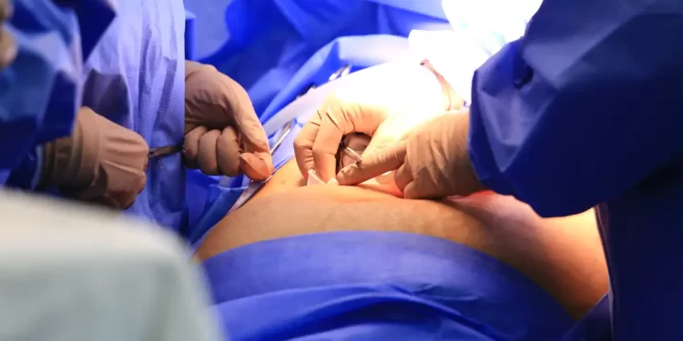 Cinco estados podem zerar fila de cirurgias no SUS