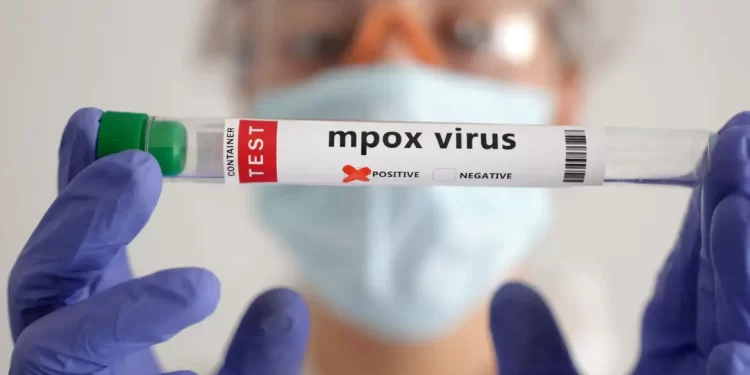 OMS: África soma quase 30 mil casos suspeitos de mpox este ano