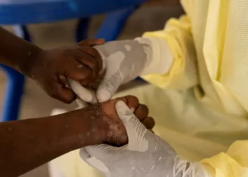 Casos de mpox no Brasil este ano já superam o total de 2023