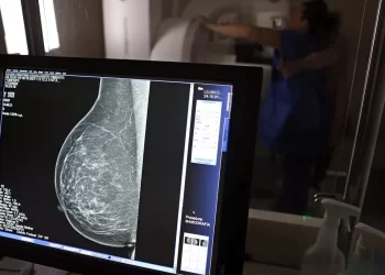 Ministério da Saúde passa a recomendar mamografia a partir dos 40 anos