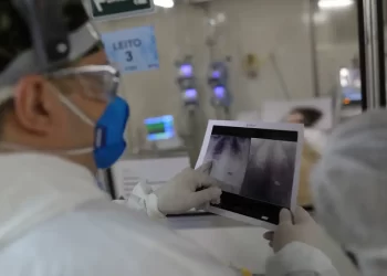 Covid é principal causa de internação por síndrome respiratória no Rio