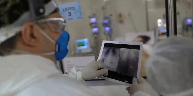 Covid é principal causa de internação por síndrome respiratória no Rio