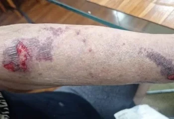 Fim de ano traz alerta de segurança para a Asa Norte