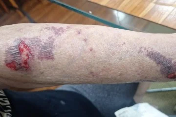 Fim de ano traz alerta de segurança para a Asa Norte