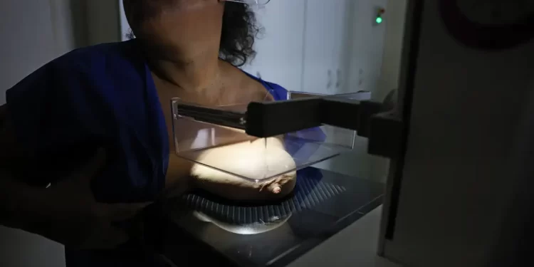 Vigitel: 92% das brasileiras entre 50 e 69 anos fizeram mamografia