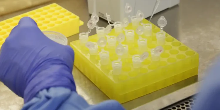 SP confirma segundo caso importado de sarampo