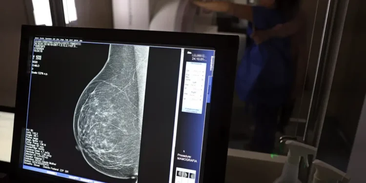 Plano de saúde terá que cobrir mamografia digital para todas as idades